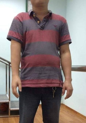 Tay dưới khuỷu