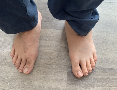 SILICON THẨM MỸ