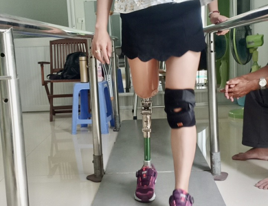 Chân giả trên gối
