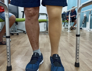 Chân giả trên gối