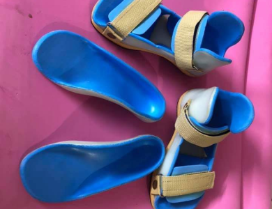 Nẹp nắn chỉnh bàn chân bẹt
