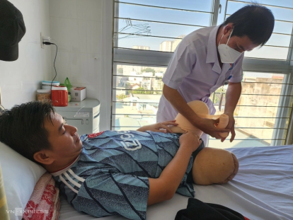 chăm sóc mỏm cụt sau cắt cụt