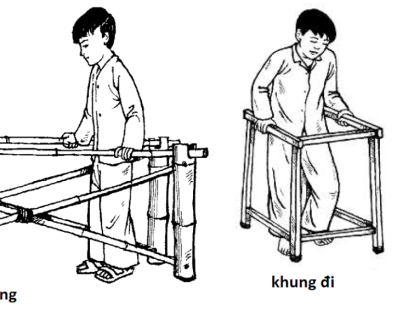 DỤNG CỤ PHỤC HỒI CHỨC NĂNG TỰ LÀM TẠI CỘNG ĐỒNG