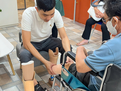khám tư vấn thiết kế chân giả dưới gối