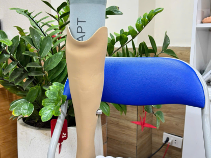 quy trình lắp chân giả dưới gối 