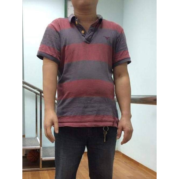 Tay dưới khuỷu