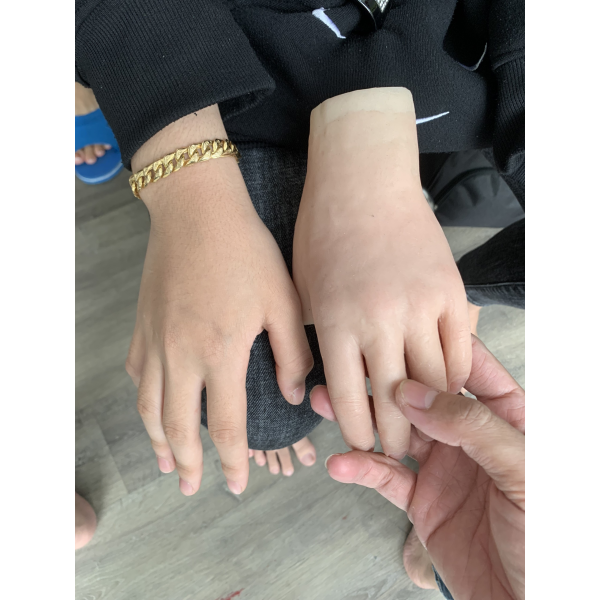 SILICON THẨM MỸ