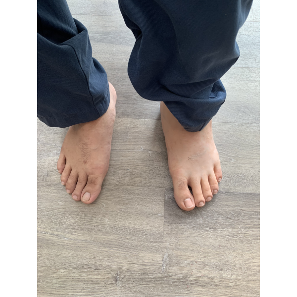 SILICON THẨM MỸ