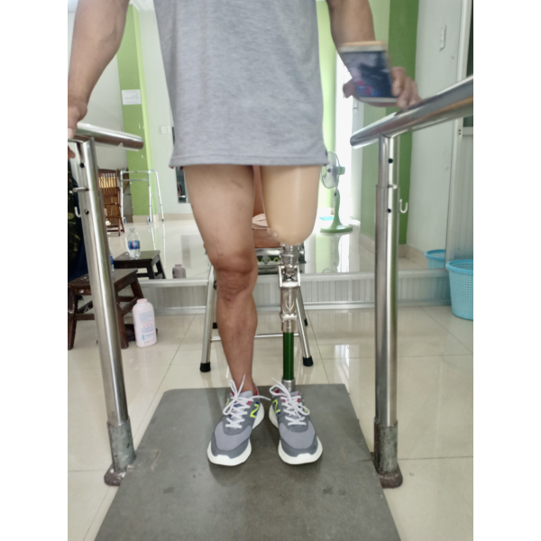 Chân giả trên gối