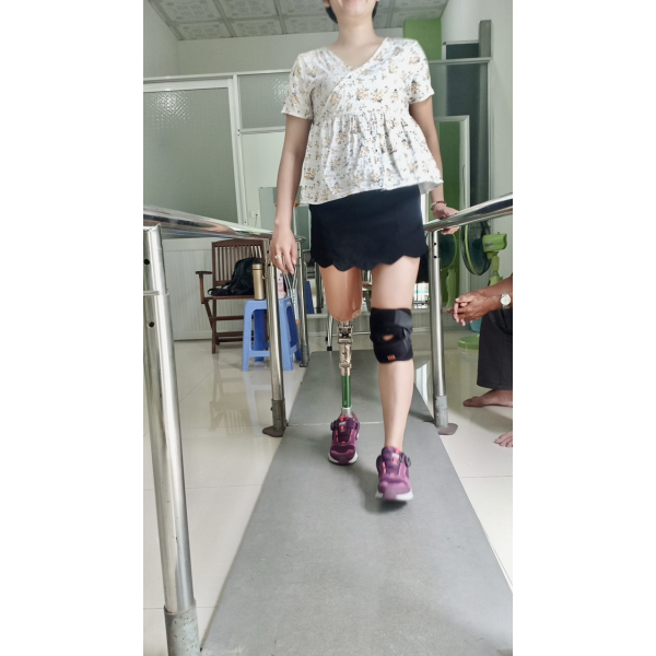 Chân giả trên gối