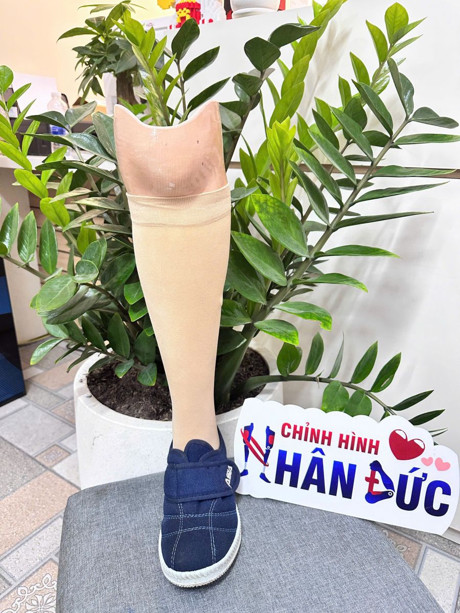 bọc thẩm mỹ chân giả