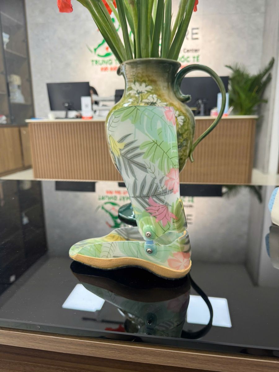 nẹp chỉnh hình