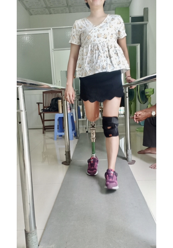Chân giả trên gối