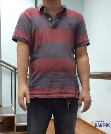 Tay dưới khuỷu